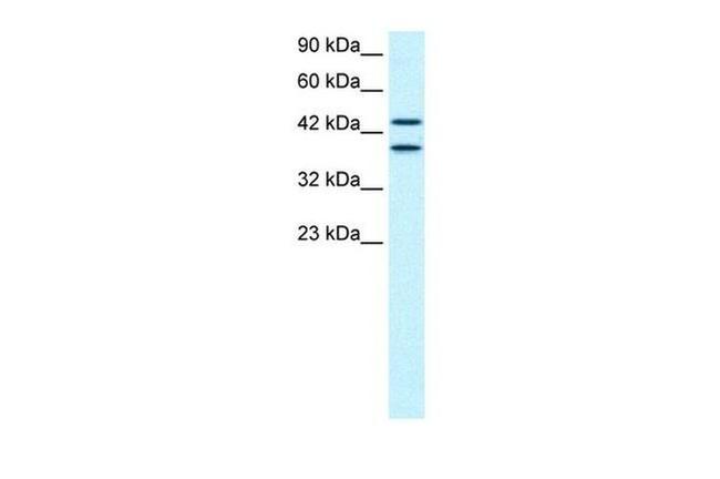 ZNF839 Antibody in Western Blot (WB)