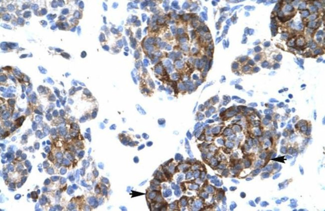 BarX1 Antibody in Immunohistochemistry (IHC)