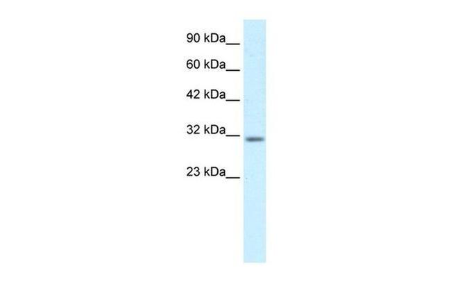 BarX1 Antibody in Western Blot (WB)