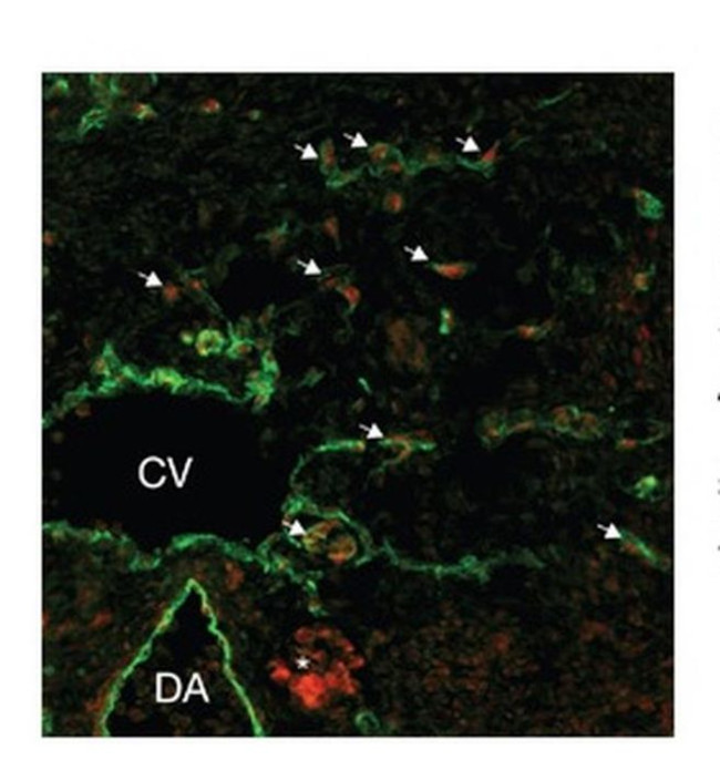 SOX18 Antibody in Immunocytochemistry (ICC/IF)