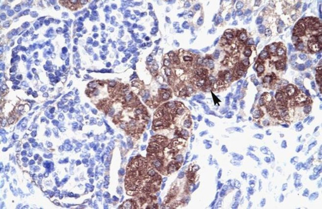 SOX18 Antibody in Immunohistochemistry (Paraffin) (IHC (P))