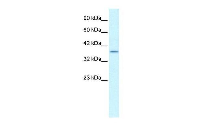 SOX18 Antibody in Western Blot (WB)