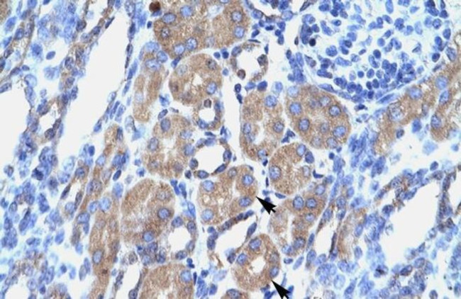 OCT6 Antibody in Immunohistochemistry (IHC)