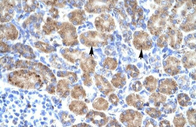 POU4F3 Antibody in Immunohistochemistry (IHC)