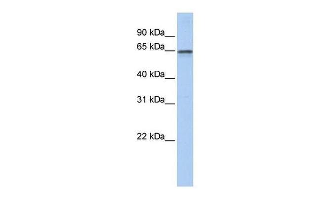 AdoHcyase 2 Antibody in Western Blot (WB)