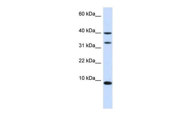 Diazepam Binding Inhibitor Antibody in Western Blot (WB)