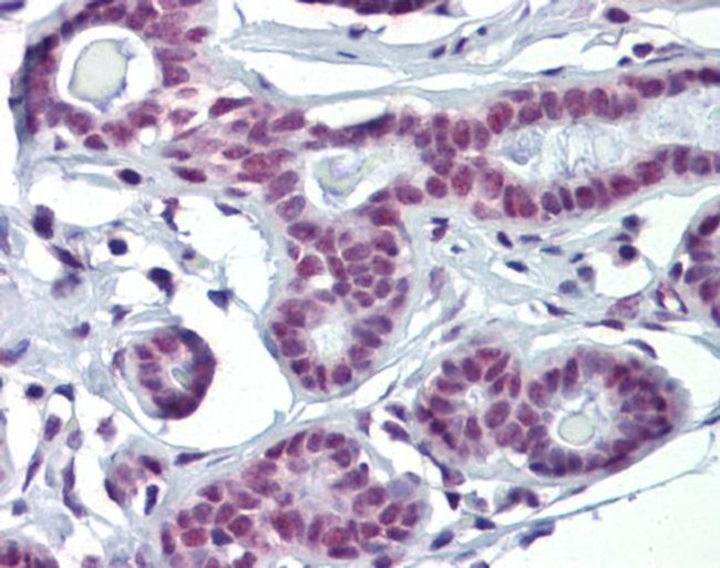 SOX4 Antibody in Immunohistochemistry (IHC)