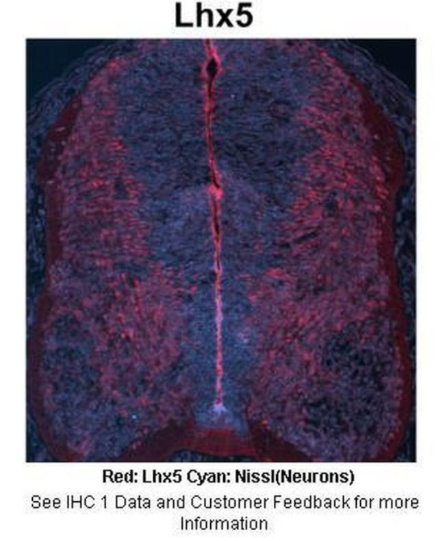 LHX5 Antibody in Immunohistochemistry (IHC)