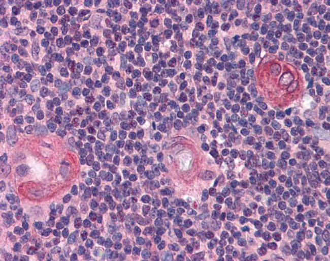 BCL11B Antibody in Immunohistochemistry (IHC)