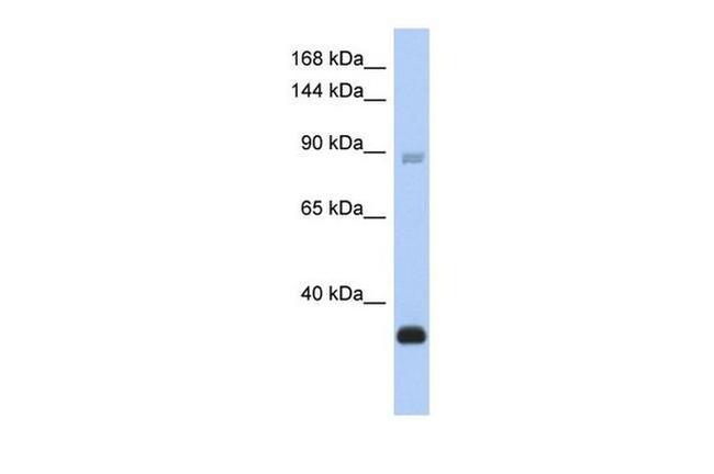 BCL11B Antibody in Western Blot (WB)