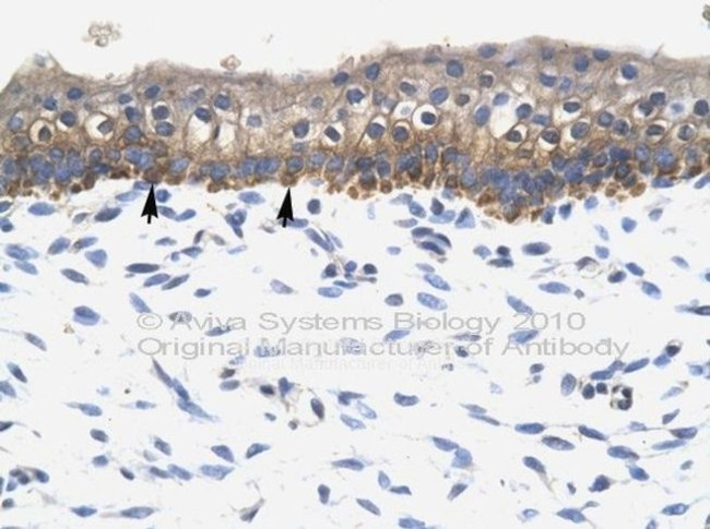 SOX10 Antibody in Immunohistochemistry (Paraffin) (IHC (P))