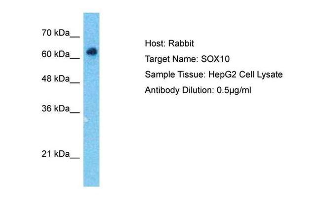 SOX10 Antibody in Western Blot (WB)