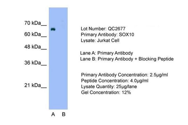 SOX10 Antibody in Western Blot (WB)