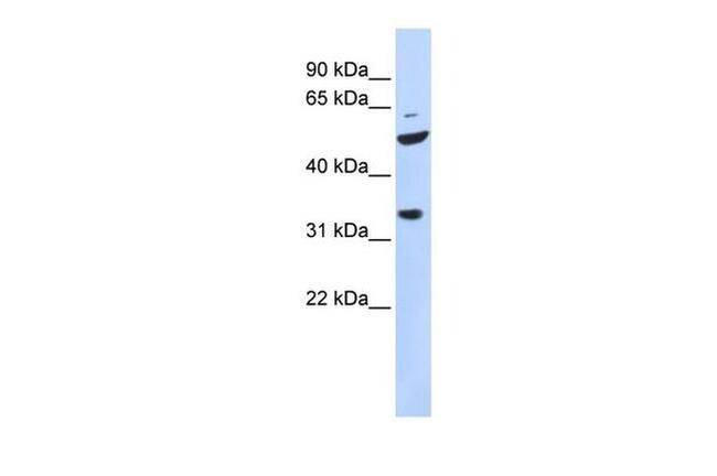 TIS11D Antibody in Western Blot (WB)