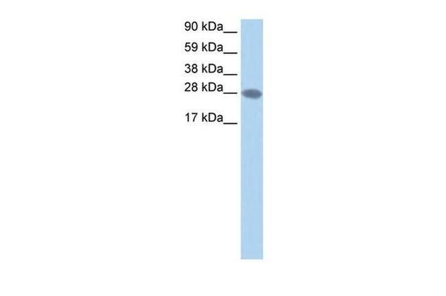 TCEA2 Antibody in Western Blot (WB)