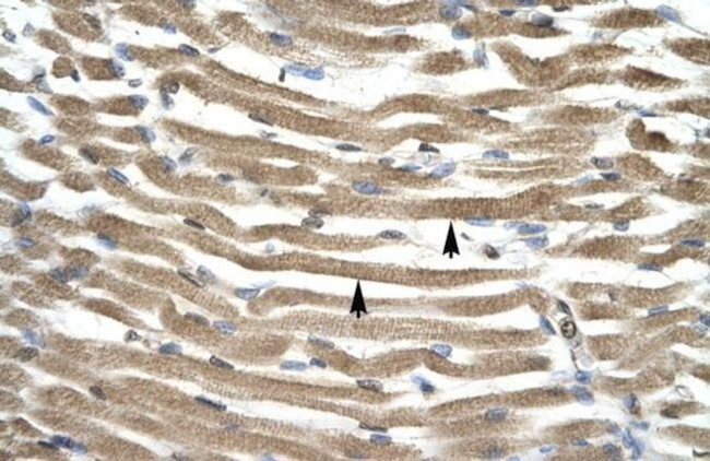 TFAP4 Antibody in Immunohistochemistry (IHC)