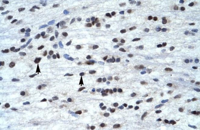 TFAP4 Antibody in Immunohistochemistry (IHC)