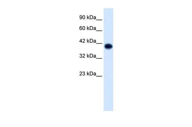 TFAP4 Antibody in Western Blot (WB)