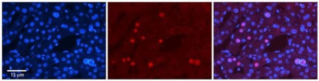 ZNF3 Antibody in Immunohistochemistry (Paraffin) (IHC (P))