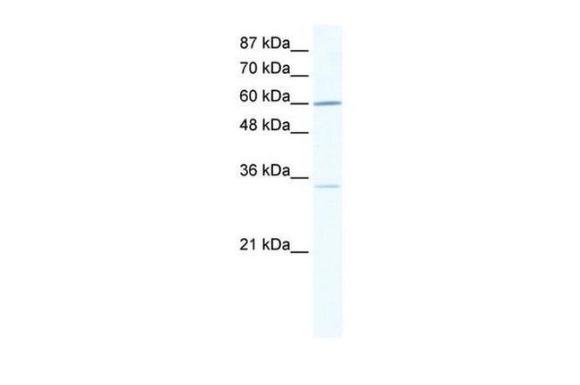 ZNF668 Antibody in Western Blot (WB)