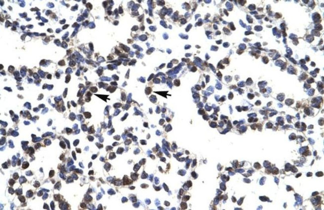 LHX3 Antibody in Immunohistochemistry (IHC)