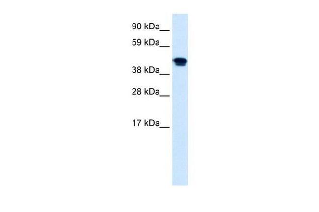 FXR Antibody in Western Blot (WB)