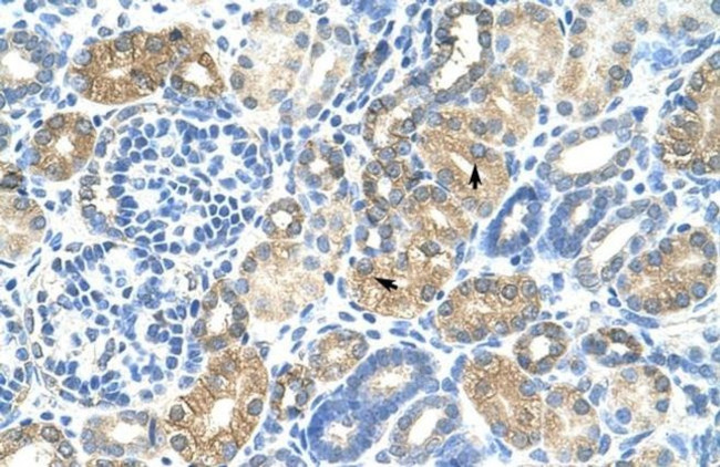 MAFB Antibody in Immunohistochemistry (IHC)