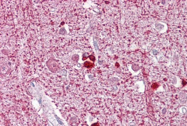 ZEB2 Antibody in Immunohistochemistry (IHC)