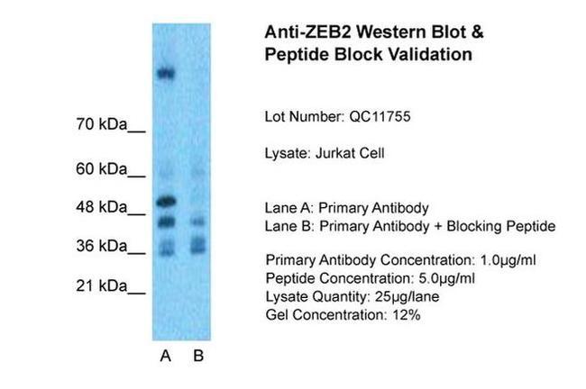 ZEB2 Antibody in Western Blot (WB)