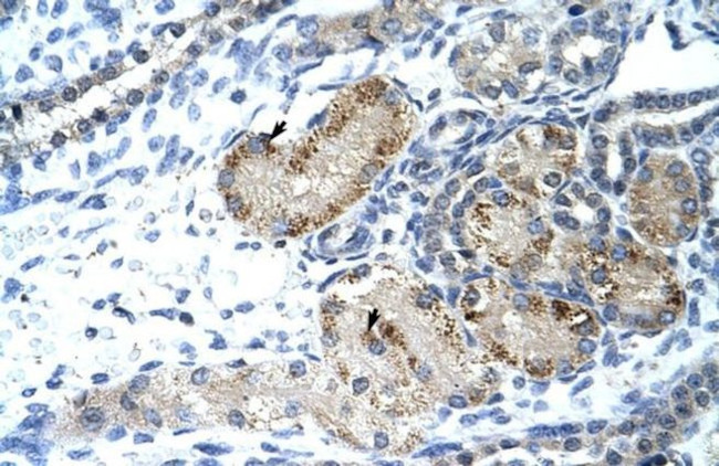 GTF2IRD1 Antibody in Immunohistochemistry (IHC)