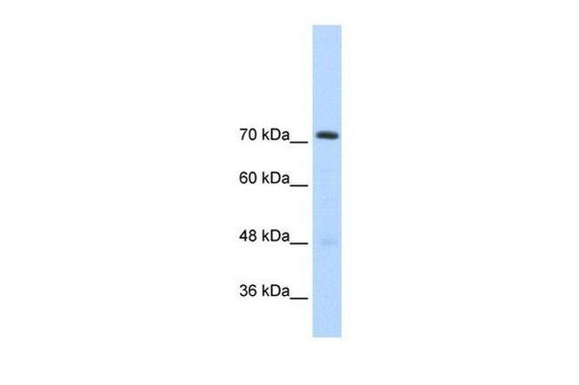 GTF2IRD1 Antibody in Western Blot (WB)