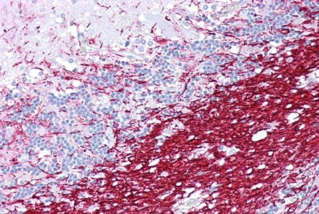 PLP1 Antibody in Immunohistochemistry (IHC)