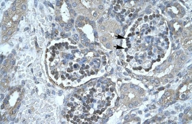 PNLIP Antibody in Immunohistochemistry (IHC)