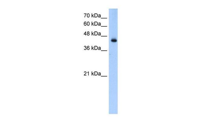 ACADL Antibody in Western Blot (WB)