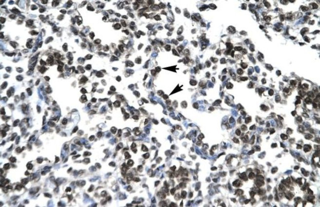 PTHLH Antibody in Immunohistochemistry (Paraffin) (IHC (P))