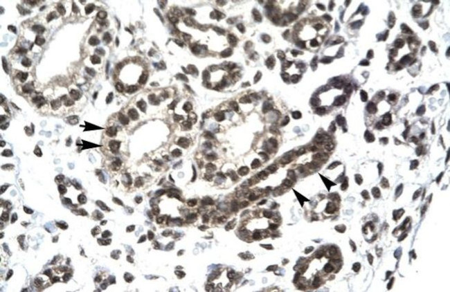 PTHLH Antibody in Immunohistochemistry (Paraffin) (IHC (P))