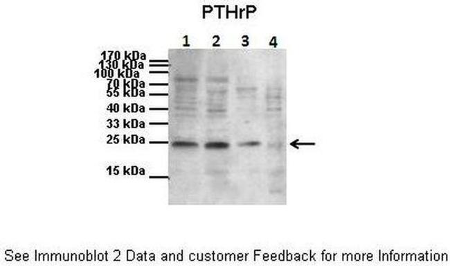 PTHLH Antibody in Western Blot (WB)