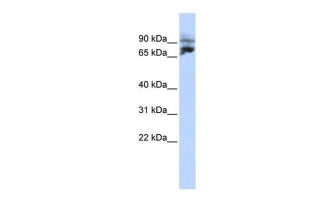 KIF2A Antibody in Western Blot (WB)