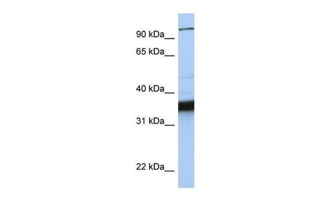 KIFC3 Antibody in Western Blot (WB)