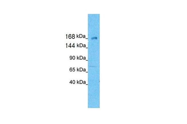 KIF21A Antibody in Western Blot (WB)