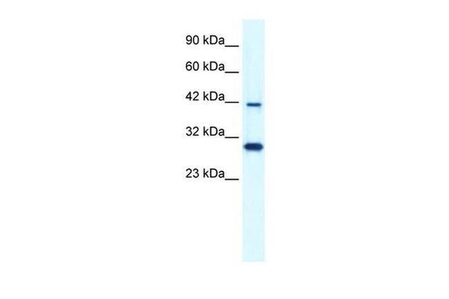 PREB Antibody in Western Blot (WB)