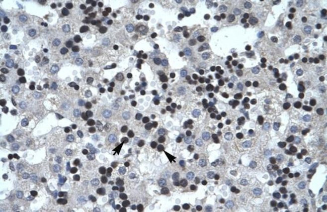 SMARCB1 Antibody in Immunohistochemistry (Paraffin) (IHC (P))