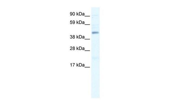 SMARCB1 Antibody in Western Blot (WB)