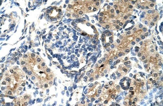 TIMELESS Antibody in Immunohistochemistry (IHC)