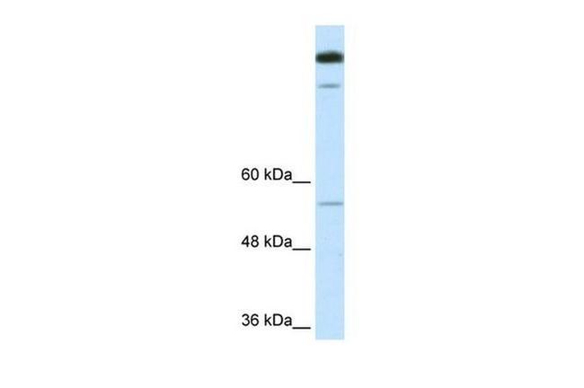 TIMELESS Antibody in Western Blot (WB)