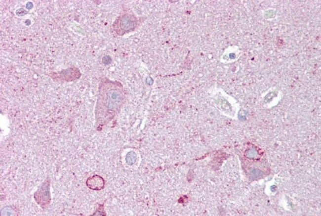 EGR3 Antibody in Immunohistochemistry (IHC)