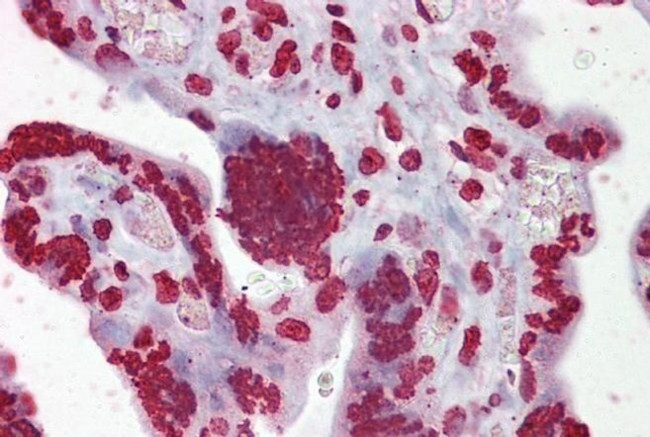 EGR3 Antibody in Immunohistochemistry (IHC)