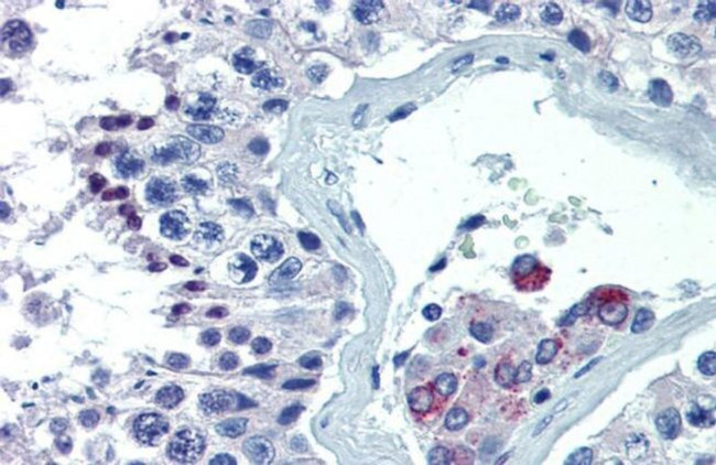 ASH2L Antibody in Immunohistochemistry (IHC)