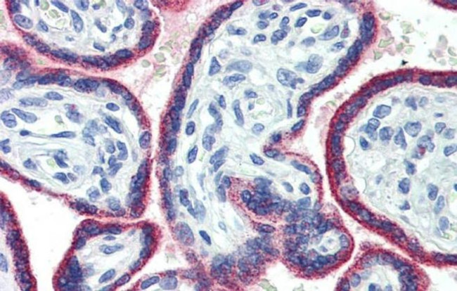 ASH2L Antibody in Immunohistochemistry (IHC)