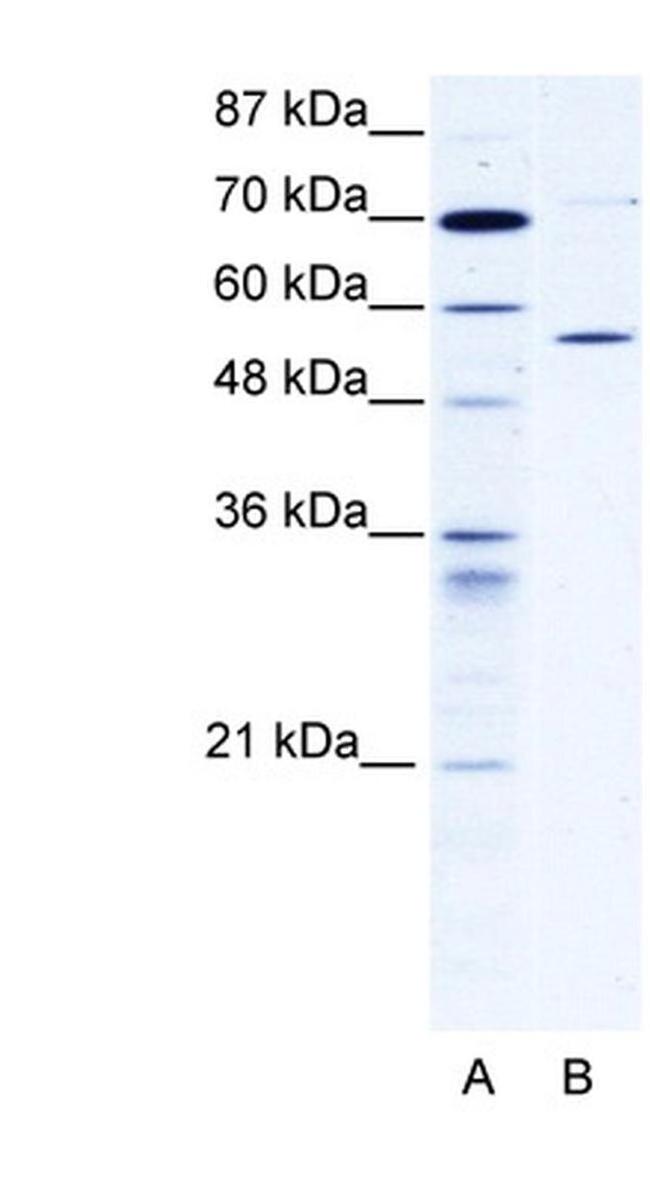 TCP-1 delta Antibody in Western Blot (WB)